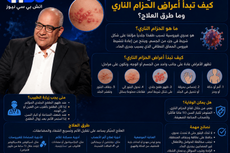 بعد إصابة بيومي فؤاد.. كيف تبدأ أعراض الحزام الناري وما طرق العلاج؟